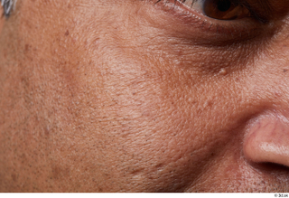 HD Face Skin Steven Hungan cheek face scar skin pores…